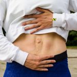 What Is Diastasis Recti?