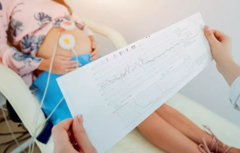 Learn About Periodic Fetal Heart Monitoring Options